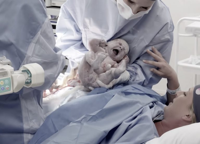 פגיעה בשלפוחית השתן בלידה