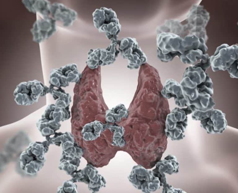 היפוקלצמיה