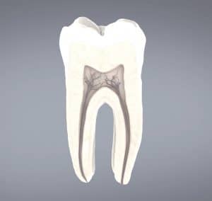 רשלנות רפואית שיניים