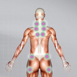 fibromyalgia road accident