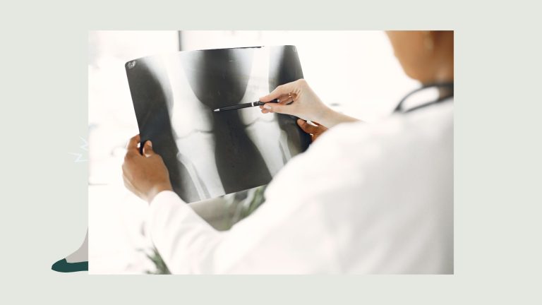 קביעת נכות לאחר שבר בברך.